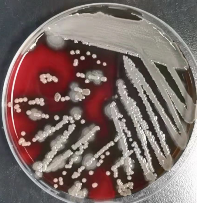 图3 纯分培养48h后血琼脂平板上细菌形态连续观察这株细菌在血琼脂