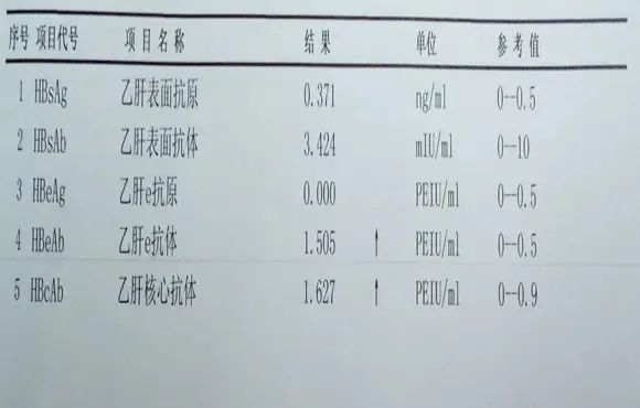 乙肝兩對半檢查報告怎麼看這7種類型一定要知道