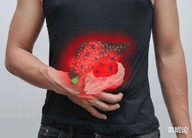 42岁男保安老林,查出肝癌晚期,或因1道"调味菜",尽量少吃