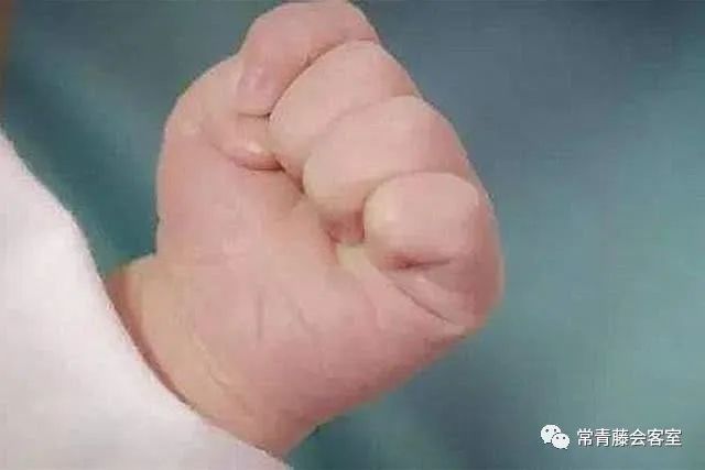 双手握拳竟是这么好的养肝动作还能挡百邪入侵快速提升阳气不可不知