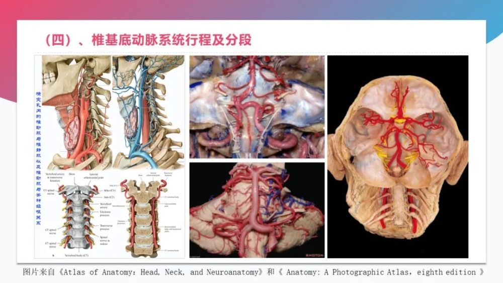 解剖血管丨脑血管解剖学习总结