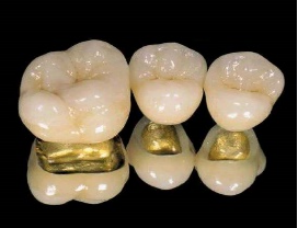 口腔医学会专栏全冠修复那些事儿