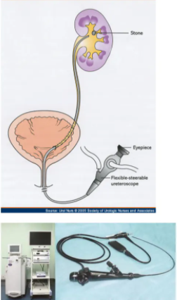 输尿管软镜结构图片