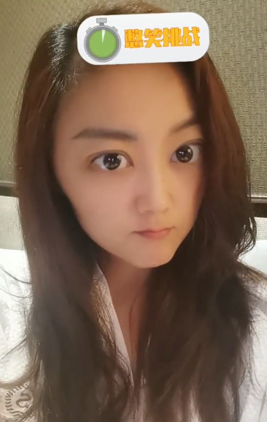 玖月奇迹王小玮晒近照酒店内录制素颜出镜黑眼圈明显引担忧