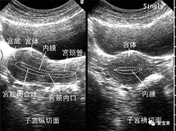 解析子宮內膜及正常範圍的相關知識