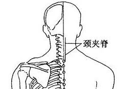 夾脊穴是經外奇穴,可調節督脈和足太陽經的經氣,緩解局部疼痛.