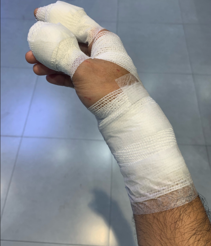 39岁唐宸禹意外受伤手上缠满纱布惹人忧曾被抑郁症困扰多年