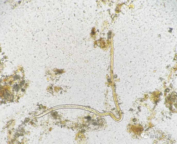 粪便及肺泡灌洗液查见的粪类圆线虫华山细胞形态专栏13