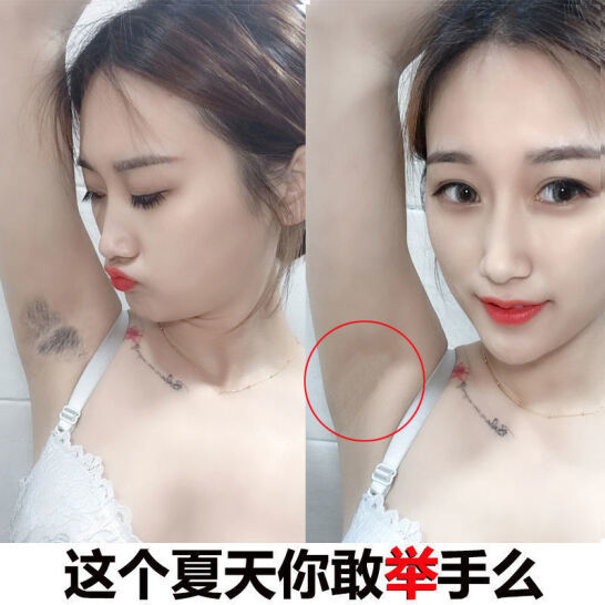 女性體毛多怎麼辦?