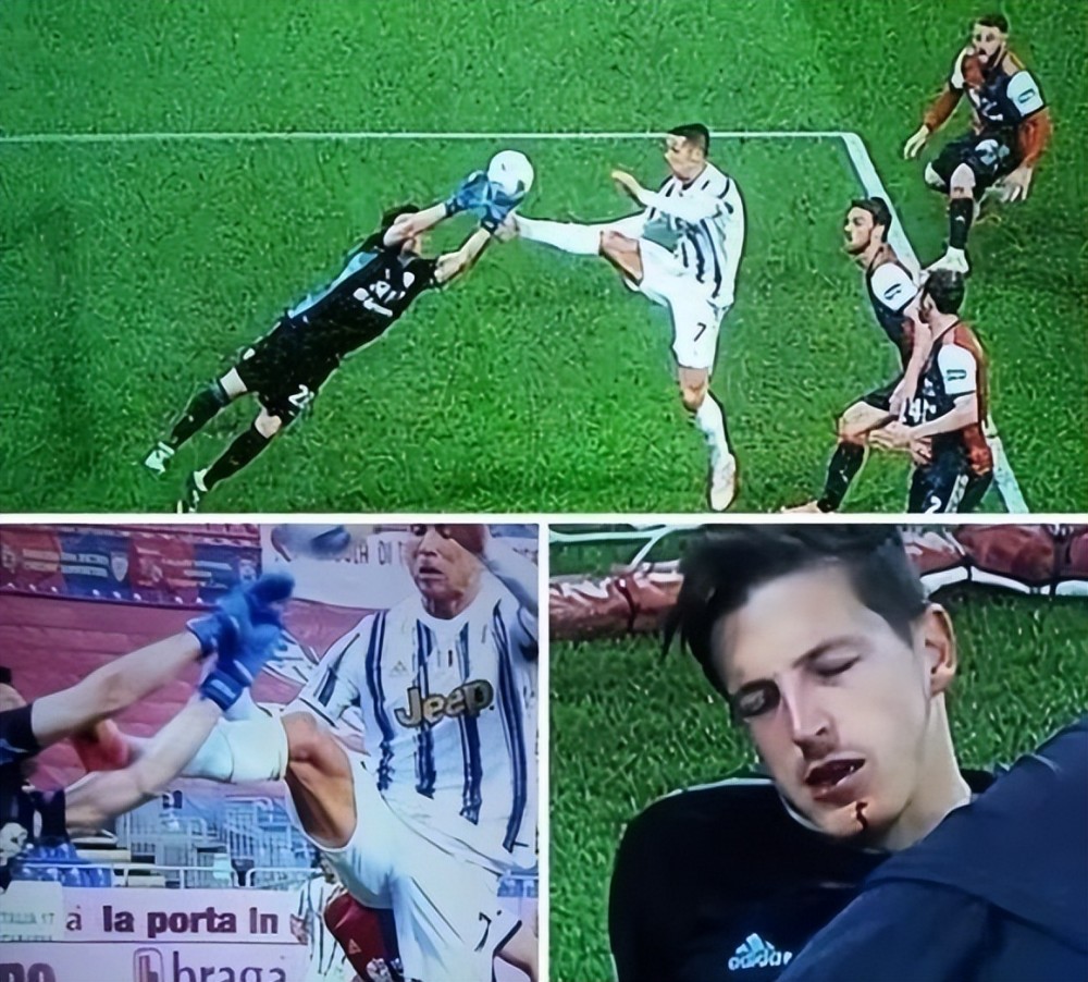 在超级杯的比赛上,c罗再度情绪失控,三拳将戈丁击倒在地而在与巴萨的