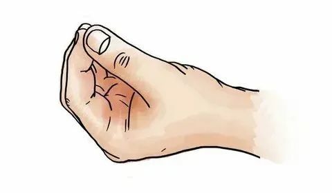 时出现或明显,能被意识暂时控制但不持久;搓丸样动作帕金森病人的手抖