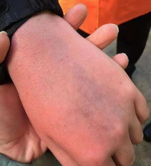 手都打肿了!c罗摔小球迷手机后没诚意道歉;老佛爷:这家伙有病