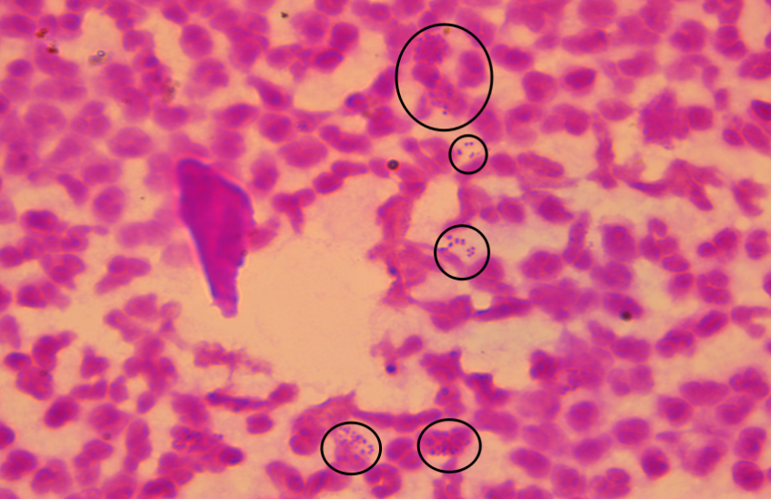 淋病双球菌图片