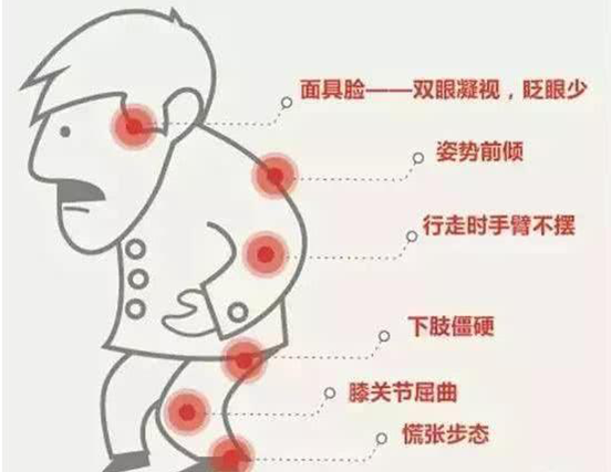 面具臉嚇人46歲的他得帕金森病