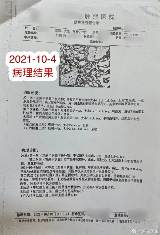 患者在当地医院手术,手术方案是:先切除左,右侧甲状腺结节送冰冻切片