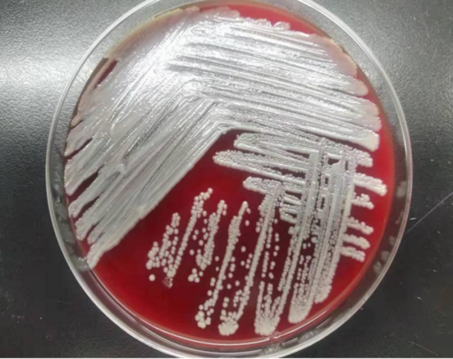 奶油色,不溶血菌落,质谱结果显示该菌为纹带棒状杆菌(分值2
