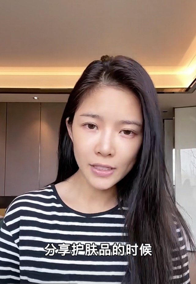 杜淳老婆王灿自曝素颜被指皮肤蜡黄和化妆后不太一样