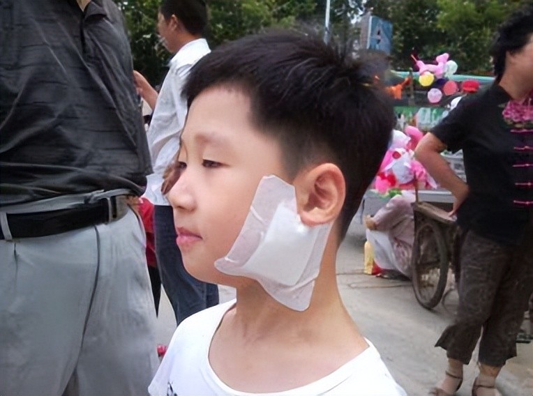 正高发爱挑孩子下手的痄腮来了还会影响生育