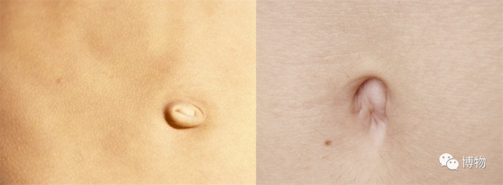 肚脐眼儿到底能不能放心大胆地抠