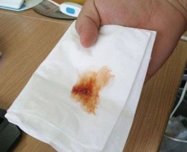 她想要吐痰,就抽了几张纸巾接着.