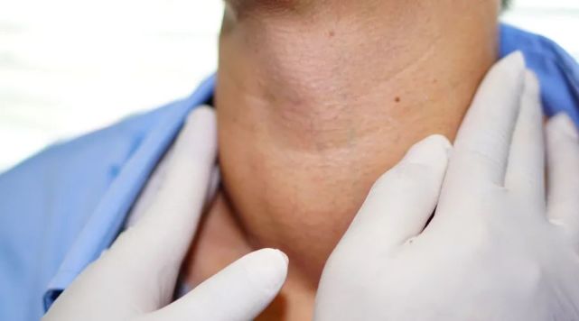 脖子变粗,是得了甲状腺结节吗?