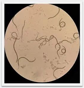 松材线虫要借助显微镜才能观察到它的全貌,成虫虫体长约1毫米,可它对