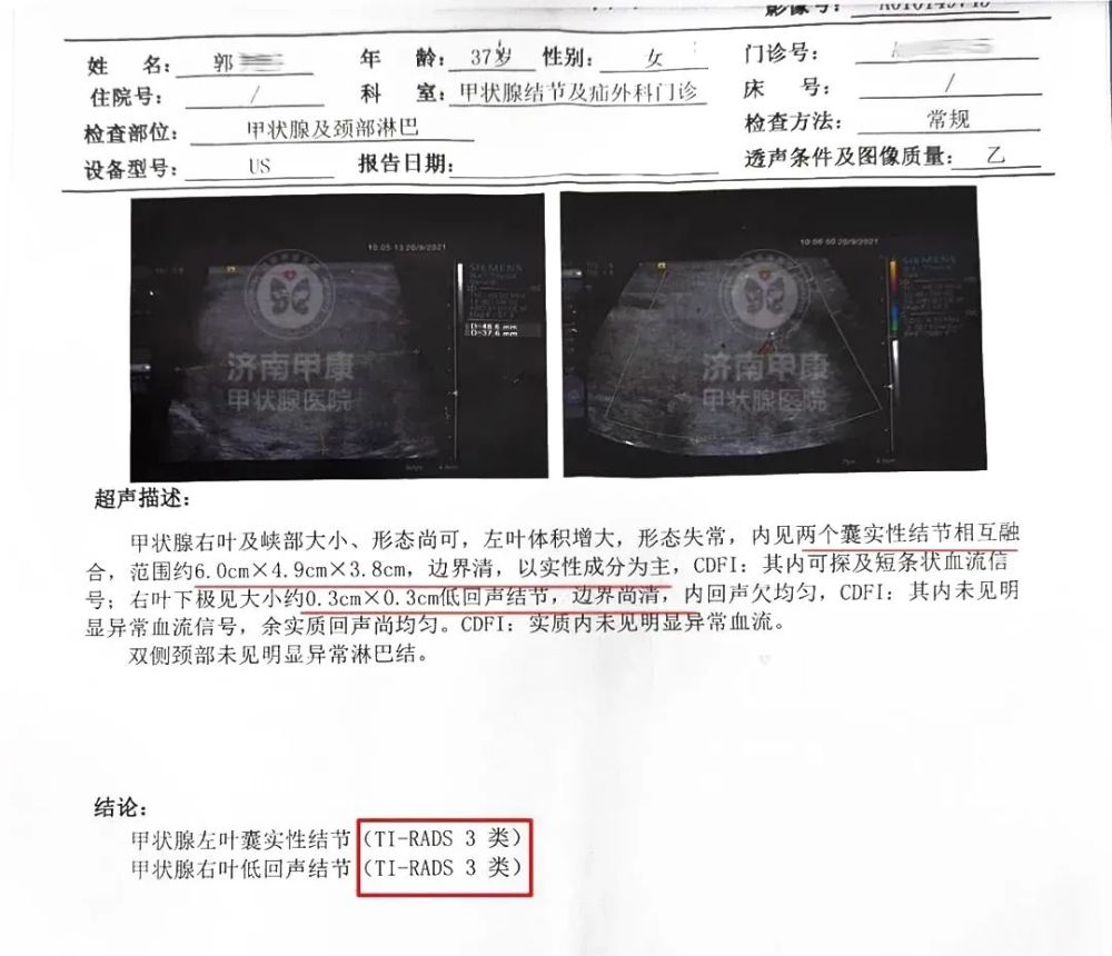 巨大囊實性甲狀腺結節6cmx5cm嚴重嗎主任不能再拖早治療早康復