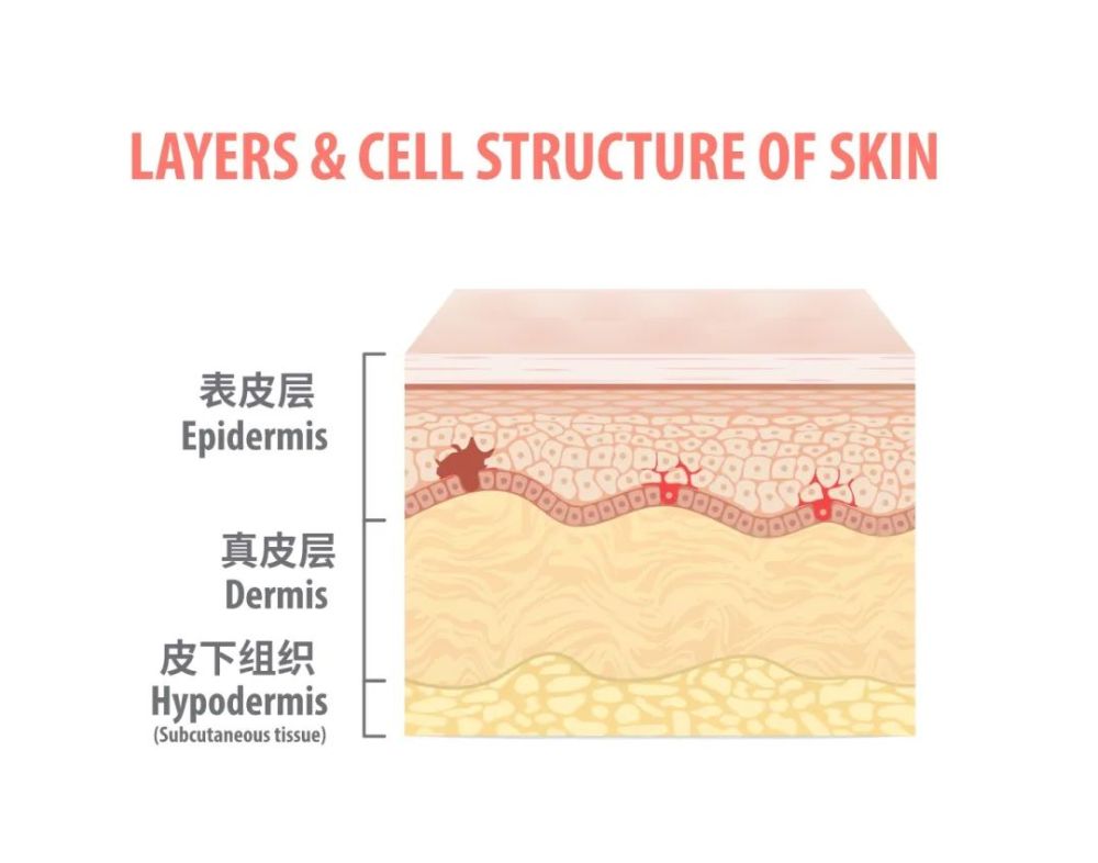人体的皮肤由表皮层,真皮层和皮下组织三部分组成