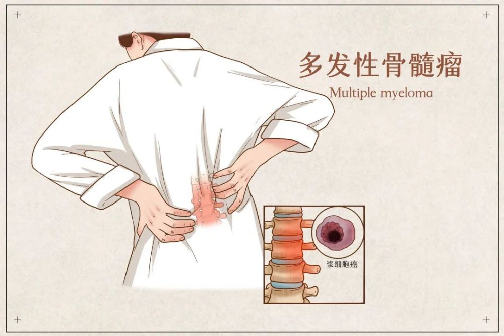 瘤经皮穿刺腰椎病变活检术家人赶紧把她送到医院李奶奶腰部疼痛加重