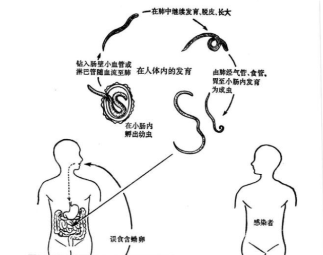 人蛔虫 腾讯网