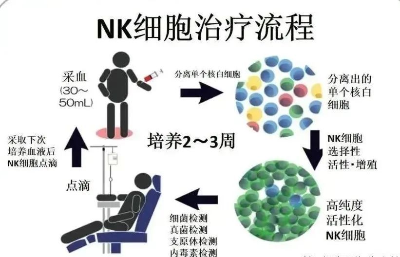 nk細胞免疫療丨維持年輕和健康的密碼