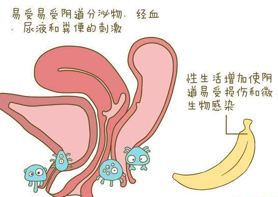 女性阴道位置尴尬生殖器官复杂,皮肤粘膜多,皮脂腺,前庭大腺,宫颈