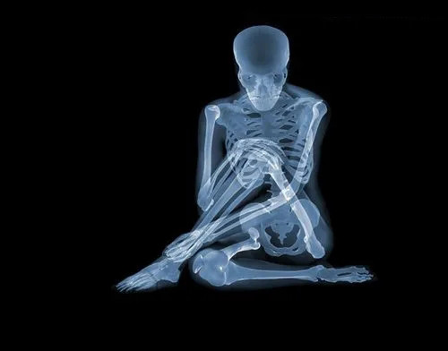 为什么体检项目中不含有pet/ct骨显像?