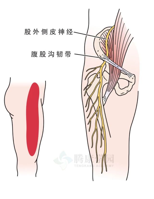 導致大腿外側疼的神經