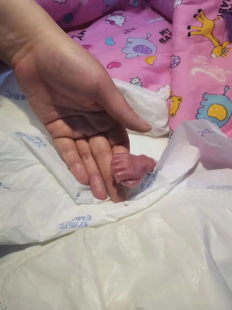 27周出生体重不足2斤心跳微弱现在她怎么样了