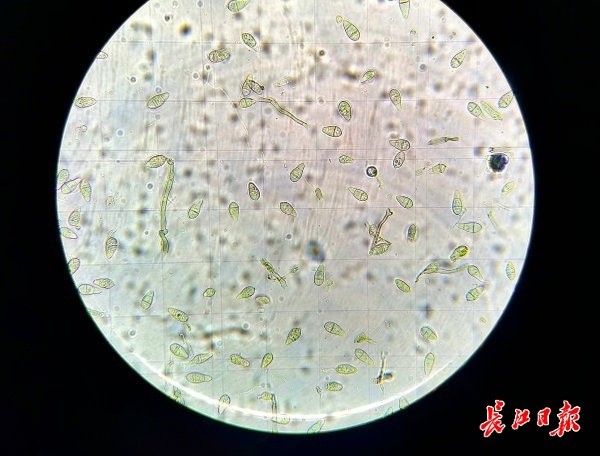 科研人员在显微镜下观察到的水稻稻瘟病菌分生孢子.