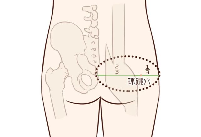 環跳穴——祛風化溼,強腰健膝,調理坐骨神經痛!