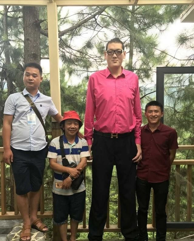 亚洲巨人张欢身高238米比姚明还高成了资本的牺牲品