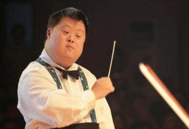 为什么唐氏综合征的人,没有遗传父母的外貌,长相都一样?