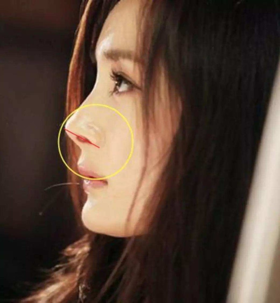 鼻子塌不算什么,"鼻孔外露"才拉垮,显老又显凶,太多人遭殃插图21