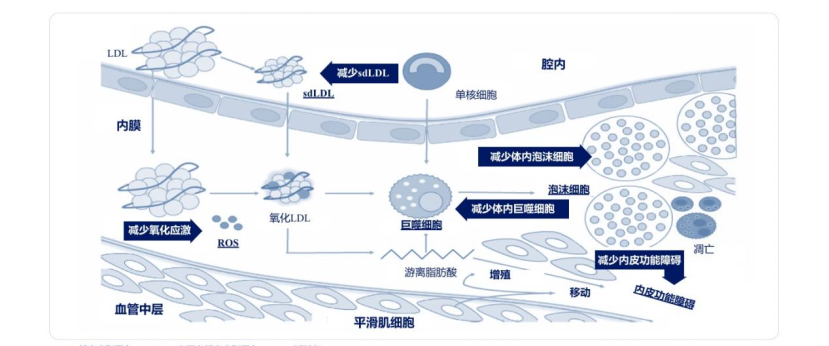 圖4 glp-1ra抑制ascvd發病機制注:ldl,低密度脂蛋白;sdldl,小而密低