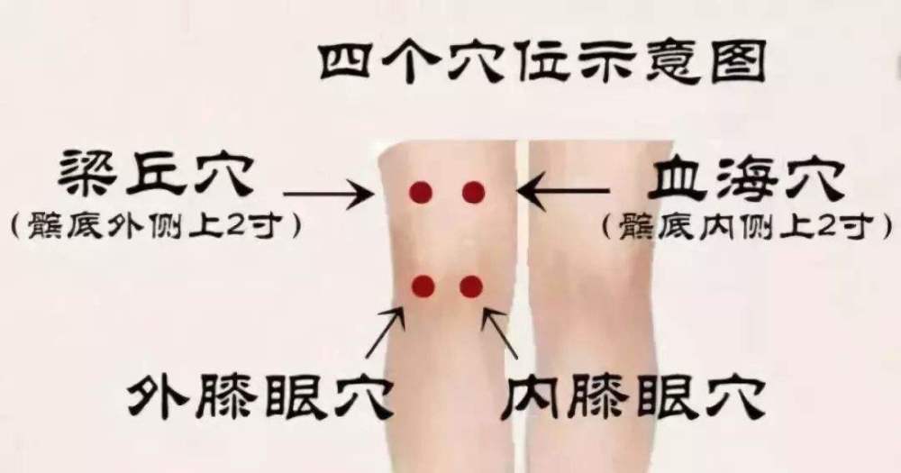 世界艾乡资讯-一针见效的针灸穴位名医医案之灸疗犊鼻穴治膝关节痛