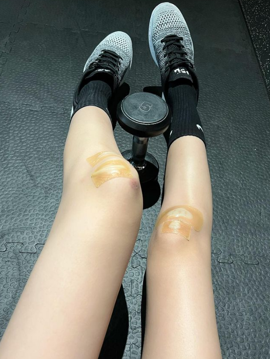 林志颖老婆晒近照,膝盖受伤仍坚持锻炼,穿运动短裤少女感十足_腾讯