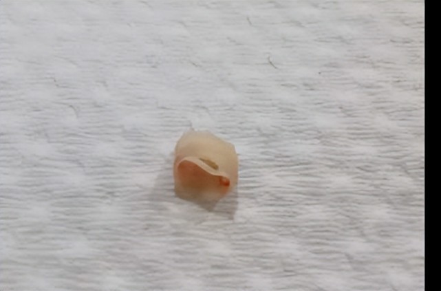 两个月的宝宝长了牙牙原因竟是