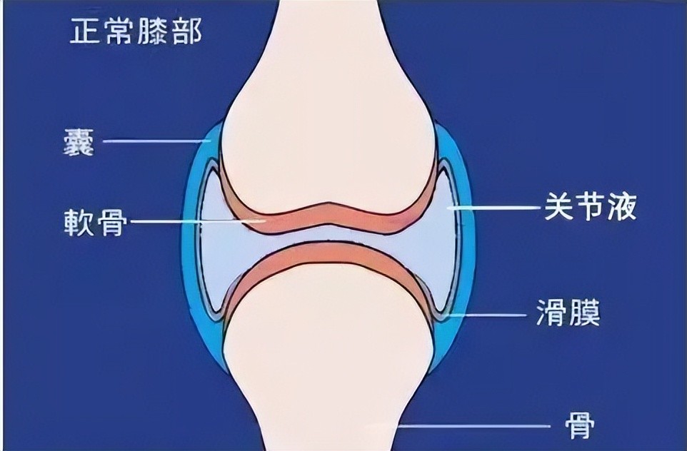 膝盖积水最佳治疗方法图片