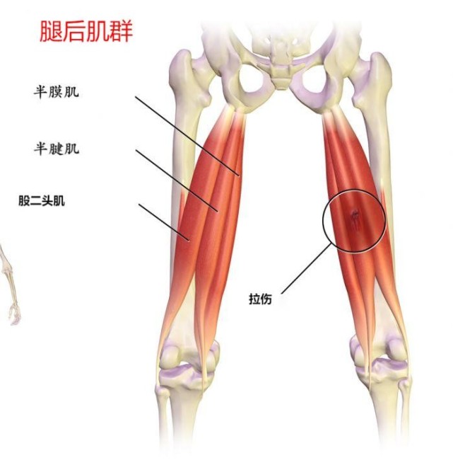 德文·布克大腿後側是如何拉傷的?能否重返季後賽場?