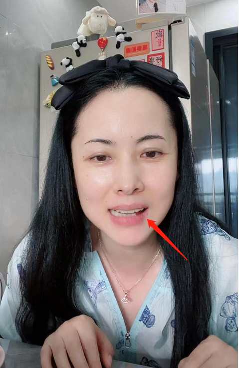 "蚌精"杨明娜直播否认整容!大力捏揉下巴鼻子,嘴里牙齿缺一颗