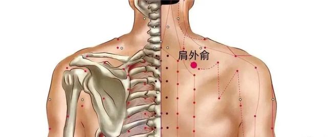 肩外俞肩背疼痛颈项强急