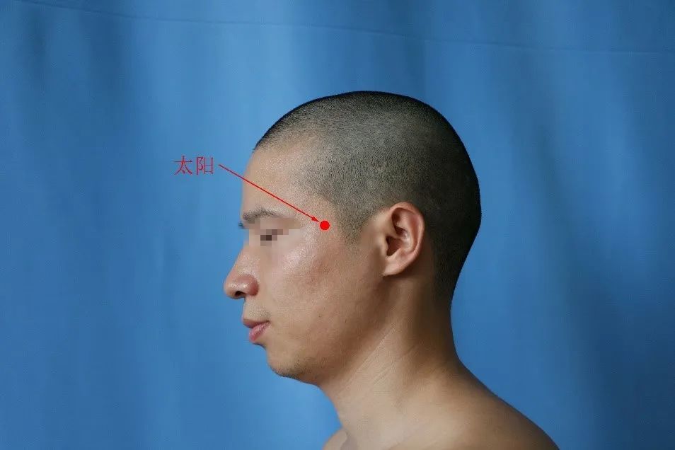 太阳[定位]:在面部,眉头凹陷中,额切迹处.