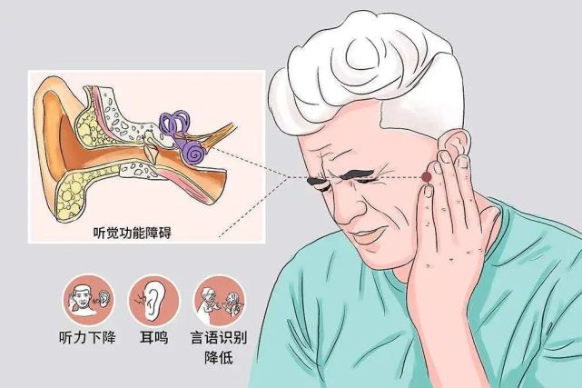 专家说丨不能耽误的急症突发性耳聋